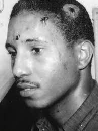 An image capturing  Rev. Dr. Bernard Lafayette, Jrs injuries sustained during  Civil  Rights protest